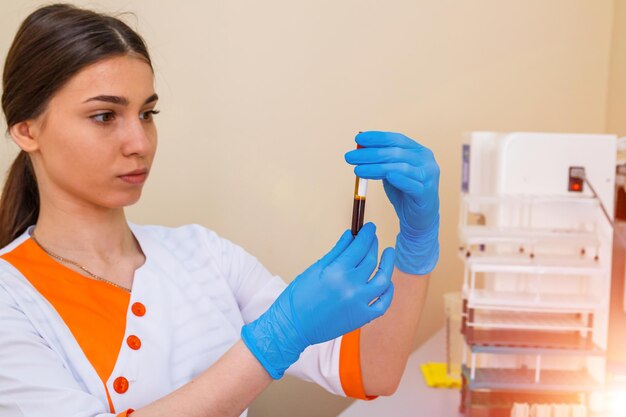 Scientist working with blood sample in laboratory Coronavirus 2019nCoV Blood Sample