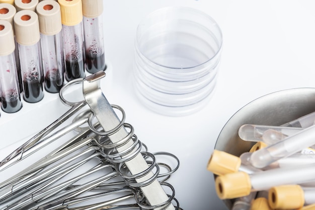 Scientists hand holding a testtube with blood sample for copy space test