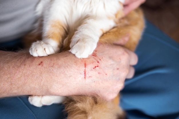 The scratched hand of the pet owner and the paws of the cat