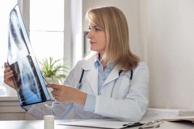 A serious thoughtful female doctor looks at an xray of the lungs and explains the diagnosis