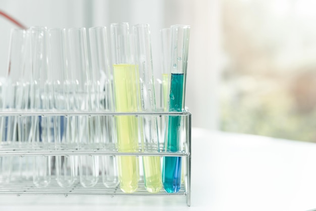 Several chemical solution in flask. Laboratory glassware. Stand with test tubes in lab.