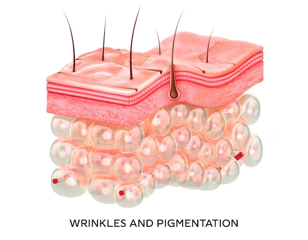 Skin with wrinkles and age spots d illustration of the structure of the skin layers microstructure