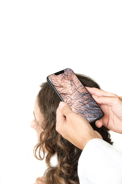 Smartphone with a dermatograph to see the capillary density on the head of a brownhaired girl with long hair