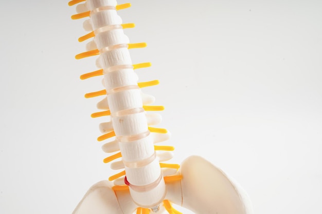 Photo spinal nerve and bone lumbar spine displaced herniated disc fragment model for treatment medical in the orthopedic department