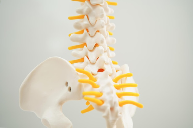 Photo spinal nerve and bone lumbar spine displaced herniated disc fragment model for treatment medical