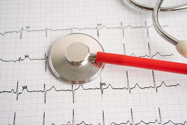 Stethoscope on electrocardiogram ECG heart wave heart attack cardiogram report