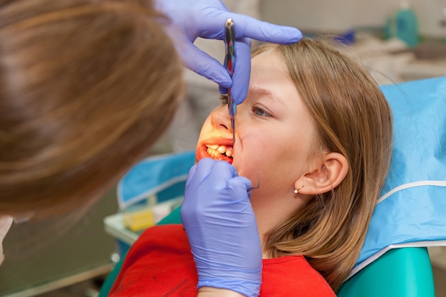 Stomatology checks up teeth for a child, girl on a reception for stomatology