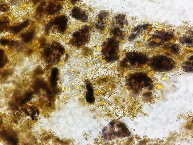 Stool examination under light microscopy. Stool analysis.