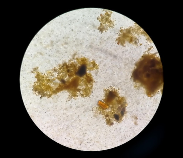 Stool examination under light microscopy. Stool analysis.