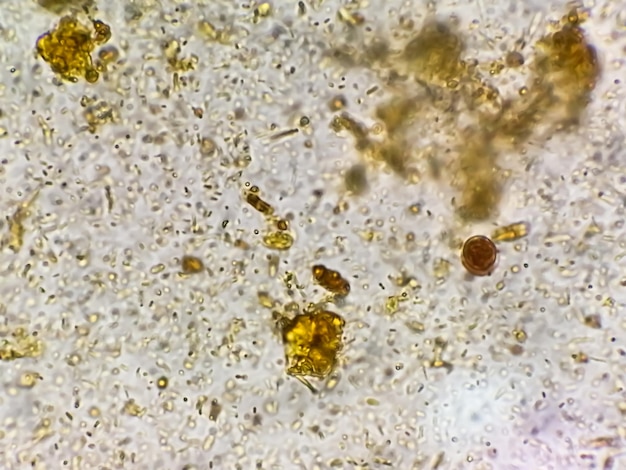 Stool examination under light microscopy. Stool analysis.