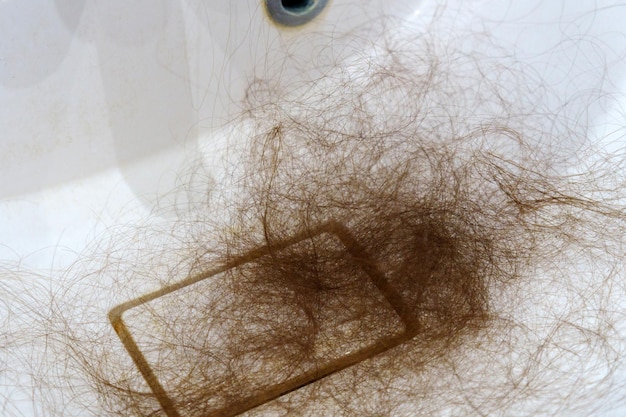 Struggles of Hair Loss A Personal Journey confronting hair loss Selective focus