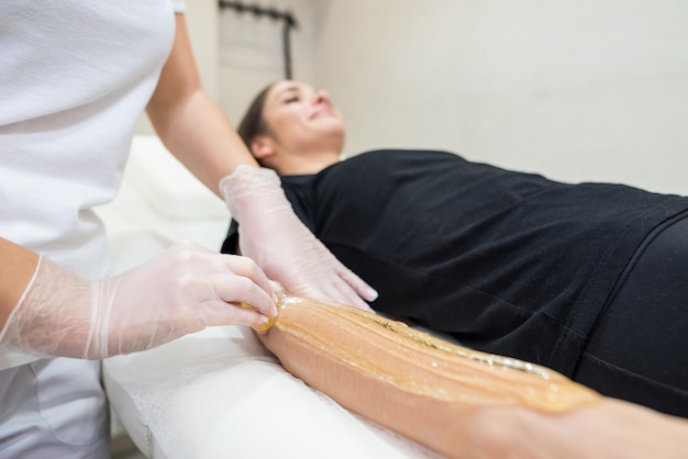 Sugar paste hair removal procedure shugaring Cosmetologist applies sugar paste to the hand of a young woman