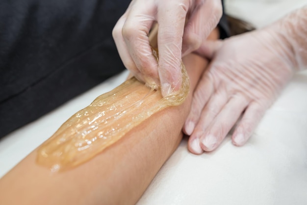 Sugar paste hair removal procedure shugaring Cosmetologist applies sugar paste to the hand of a young womanDepilation of female hands in a beauty parlor