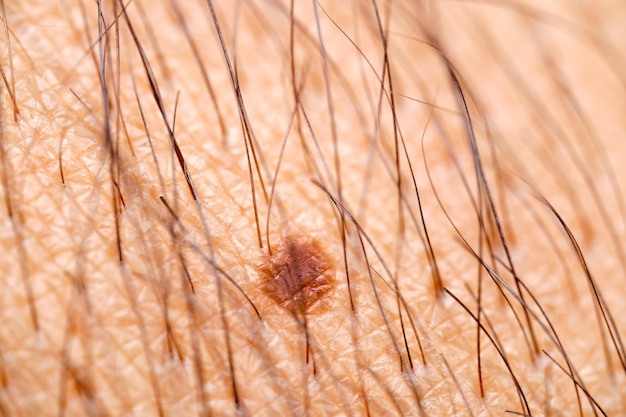 Super macro of a dark brown mole