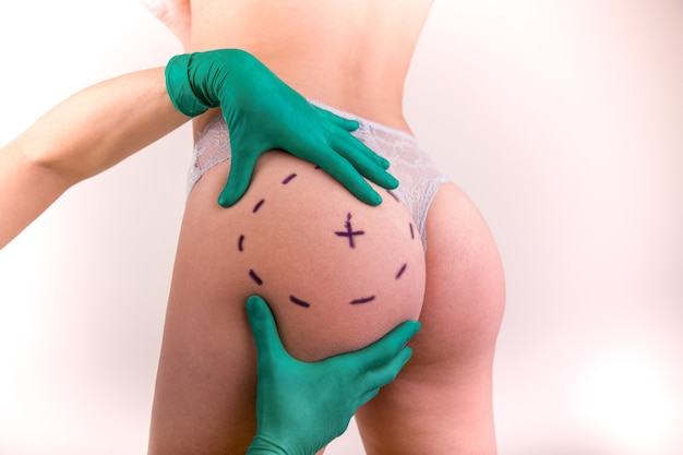 Surgeon drawing marks on female body before plastic operation, white surface