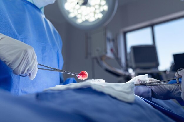 Surgeons performing surgery in operation room at hospital