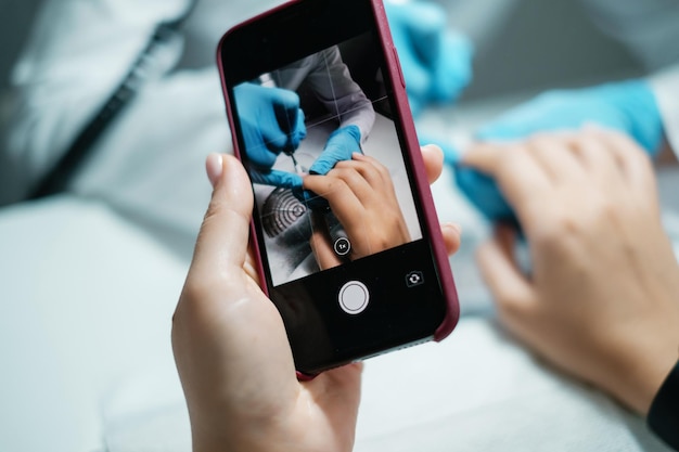 Taking photo of nail treatment Manicure process