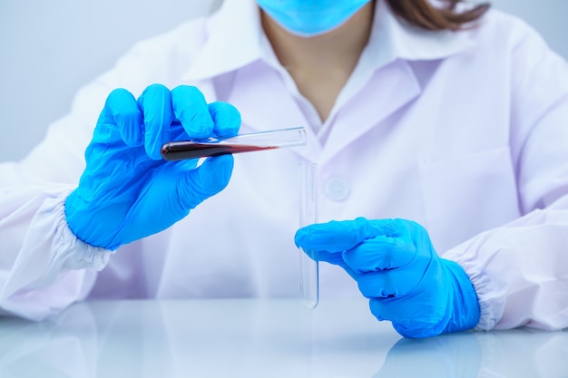 Technician scientist analyzing a blood sample in test tube in lab
oratory