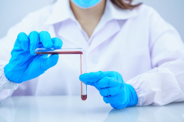 technician scientist analyzing a blood sample in test tube in laboratory for testing virus analysis