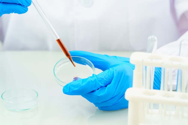 Technician scientist analyzing a blood sample on tray in laboratory for testing it on COVID, COVID-19, coronavirus virus analysis