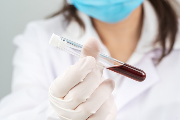 Technician scientist analyzing holding blood sample in test tube in laboratory for testing