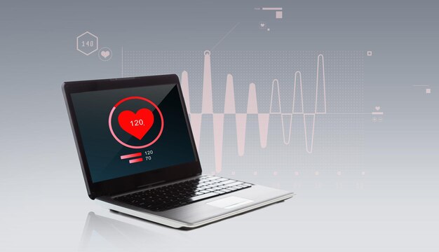 Photo technology, health care, monitoring and cardiology concept - laptop computer with heart beat icon and cardiogram