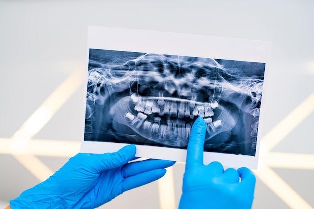 Teeth healthcare xray treatment Dentistry xray image examination