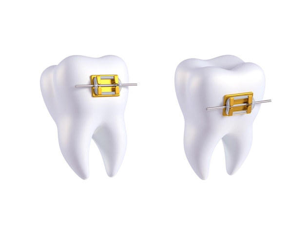 Teeth with or without golden braces Arch braces without teeth Orthodontic dentistry The alignment of the teeth Healthy lifestyle and dental care Beautiful white teeth 3d render