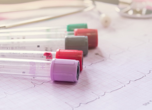 Test tube and a tube of blood.