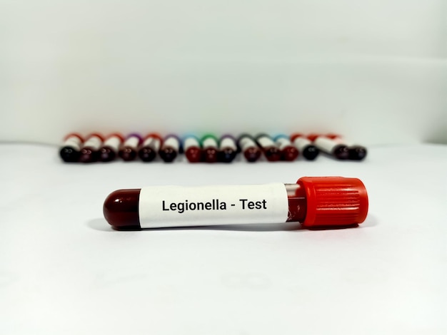 Test Tube with blood sample for Legionella test bacterial infection testing