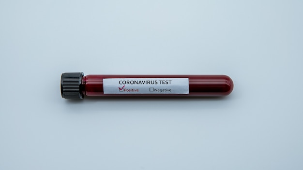 Test tube with infected blood sample for COVID-19