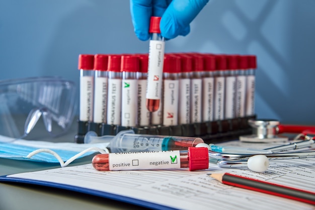 A test tube with a negative blood sample for COVID-19 against the background of vacuum tubes.  