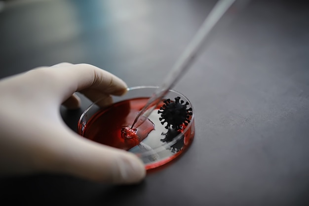 Test tube with patient blood for testing Analysis for the virus