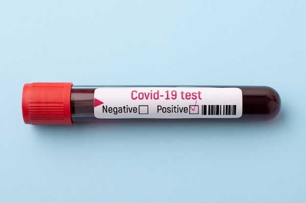 Test-tube with positive result