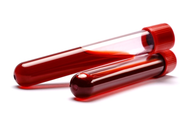 Test tube with red plug isolated on white.