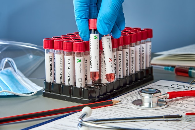 Test tubes in the doctor's hand with a positive and negative blood sample for COVID-19.  