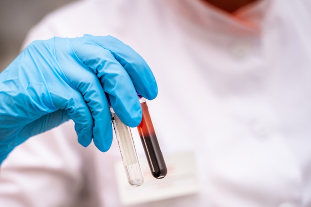 Test tubes with blood in hand