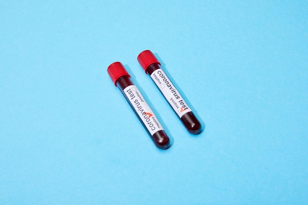 test tubes with blood samples and coronavirus test lettering on blue