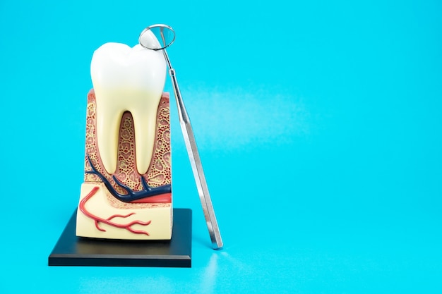 Tooth anatomy on blue background.