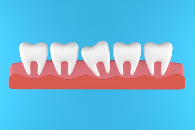 Tooth with orthodontic braces set