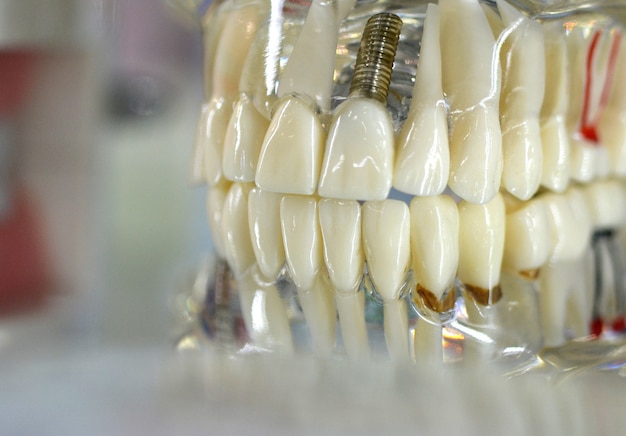 Transparent Model of Human Teeth