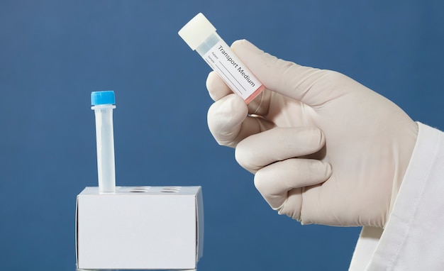 transport vial for pcr test in the hands of a doctor nurse pharmacist with blue background