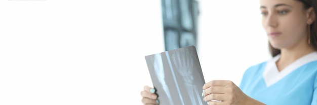 Traumatologist doctor looking at xray of hand in clinic closeup