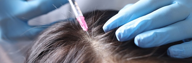 Trichologist makes an injection into scalp. Mesotherapy for hair growth concept