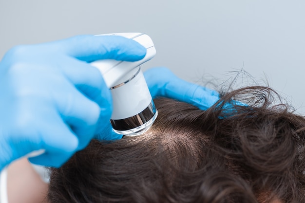 Trichoscopy of hair and scalp closeup.