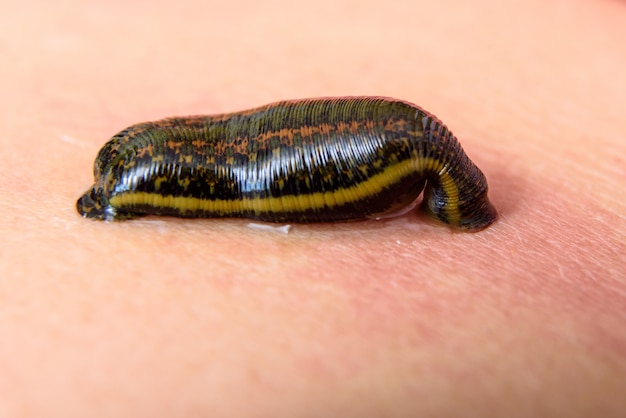 Tropical land leech sucking some blood from the skin.