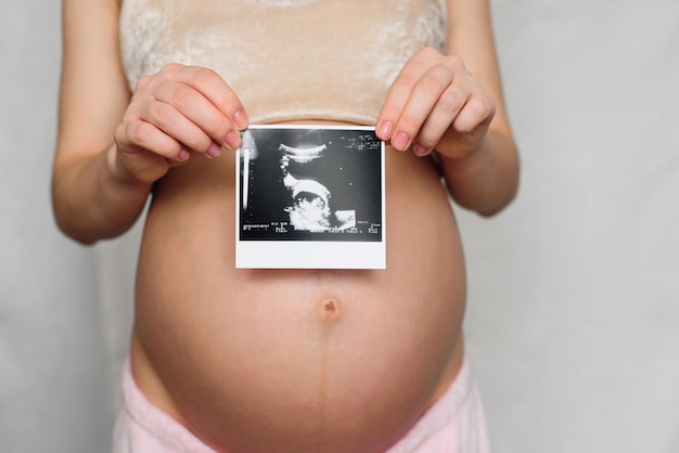 Ultrasound picture in the hands of a pregnant girl