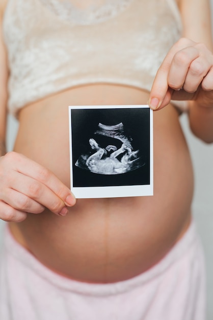 Ultrasound picture in the hands of a pregnant girl