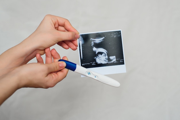 Ultrasound picture and positive pregnancy test in the hands of a girl