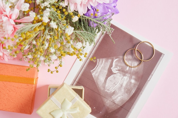 Ultrasound shot on pink background, flowers and gift box for decor, pregnancy and motherhood concept, conscious parenthood top view